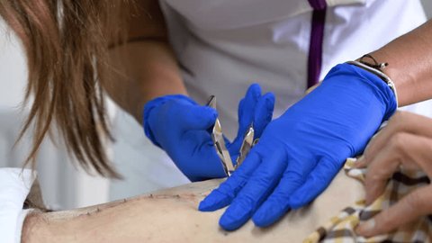 Understanding the Types of Sutures Before Removing Them